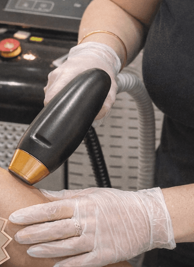 Diode laser hair removal